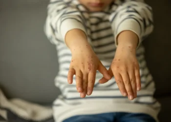 doença, viral, infecção, contagiosa, vírus, sintomas, prevenção;